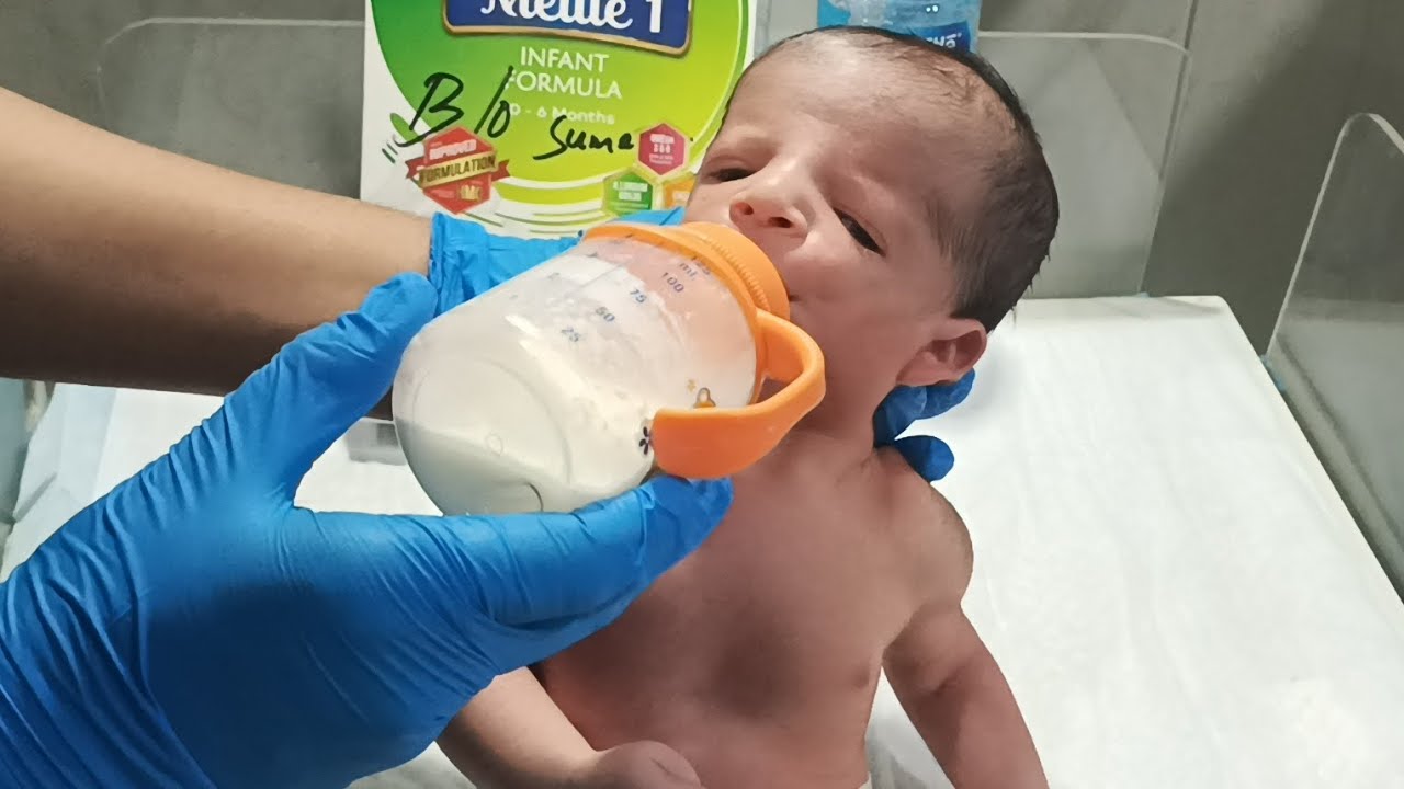 🍼🍼Feeding a Micrognathia Baby – Gentle Technique Every Nurse Should Know😊