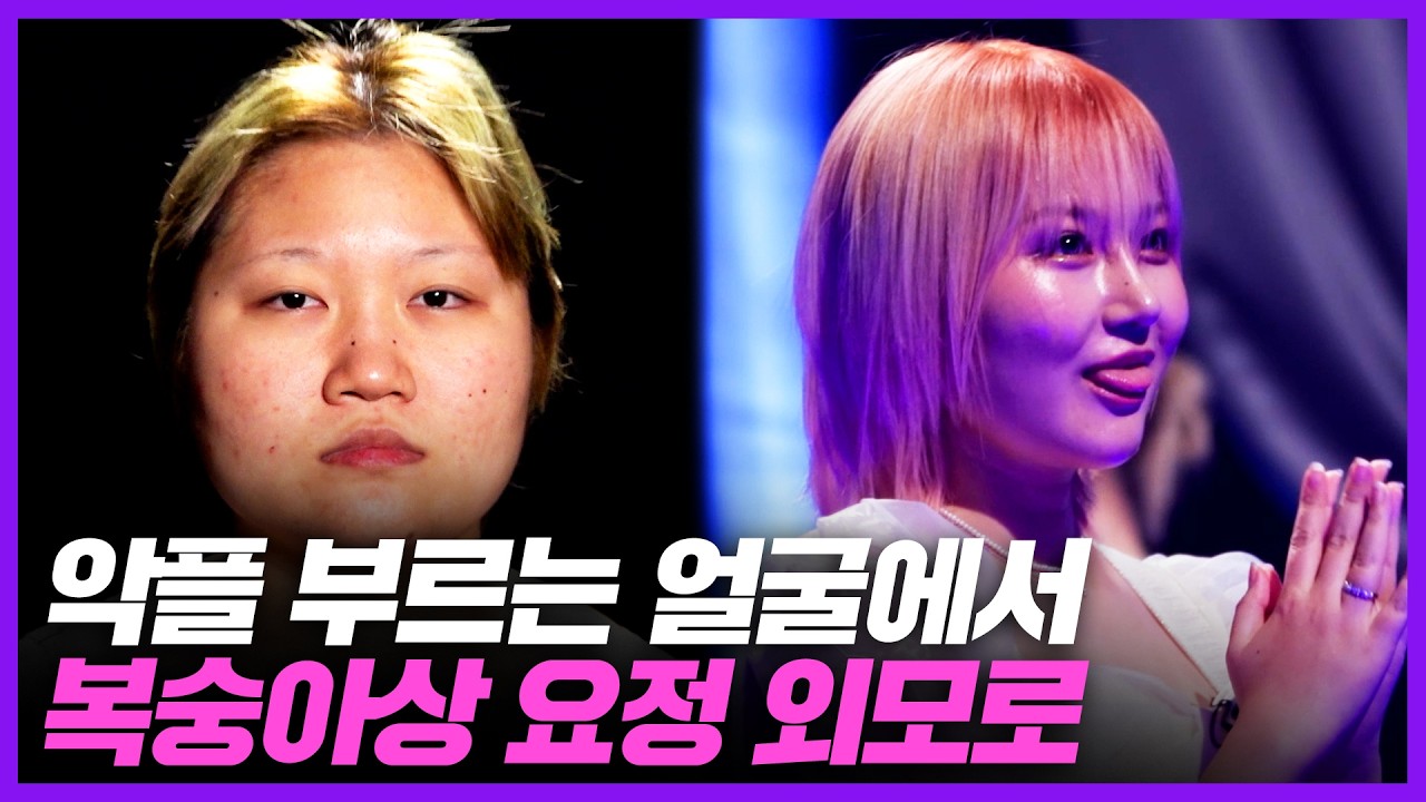 악플을 부르는 얼굴에서 복숭아상 요정 외모로 변신한 역대급 성형 후기 ㄷㄷ｜MAKE ME Girl