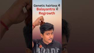 Zero Hair Loss In 2 Months | Hair Loss | Hair Fall | Hair Growth #viral #shorts