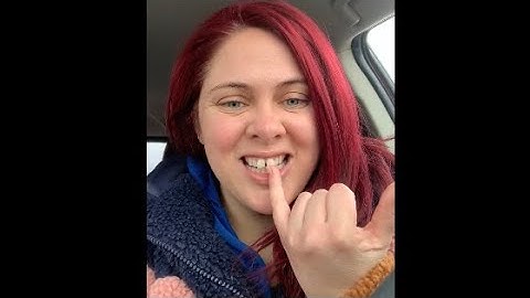 Unsponsored Byte Treatment Plan Review