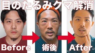 【プチ整形】手術で目のたるみ・クマの悩み解消！費用は？痛みは？ダウンタイムは？【湘南美容クリニック】