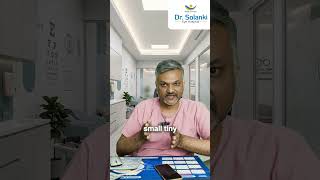 Cataract Surgery Explained in 60 Seconds