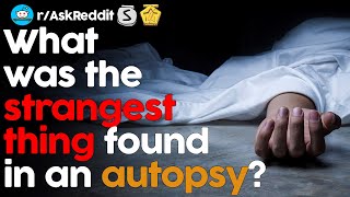 What was the STRANGEST THING found in an AUTOPSY? (r/AskReddit) Profile