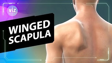 Gevleugelde schouderblad uitgelegd in 3D