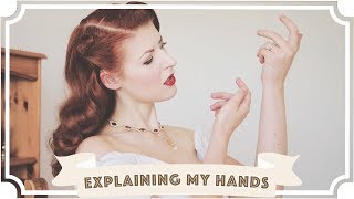Explaining what's wrong with my hands [CC]