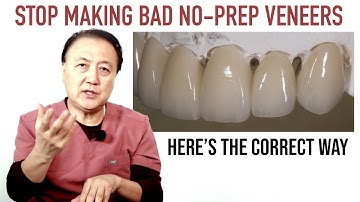 Stop Making Bad No-Prep Veneers - Here