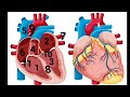 "Heart anatomy"  شرح مبسط لتشريح القلب