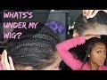 WHAT'S UNDER MY WIG? | TAKING OUT 2 MONTH OLD BRAIDS + HOW TO