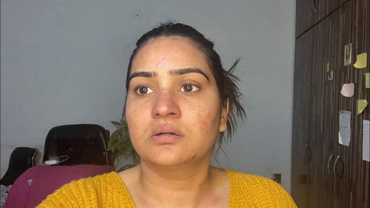 Hydroquinone Night Routine 2025: Best Way to Fade Dark Spots & Melasma