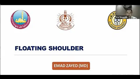 Floating Shoulder ( Prof. Emad Zayed )