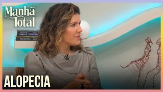 Saiba mais sobre alopecia frontal fibrosante - MANHÃ TOTAL