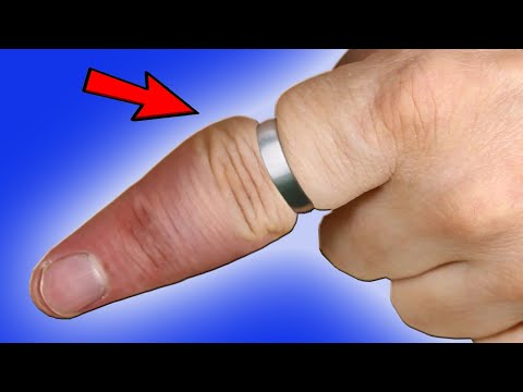 A doctor showed me how to remove the ring that was stuck on my finger. Amazing tricks. LIFE HACKS