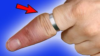 A doctor showed me how to remove the ring that was stuck on my finger. Amazing tricks. LIFE HACKS