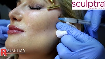 Sculptra and Dermal Filler Combo with Dr Rajani
