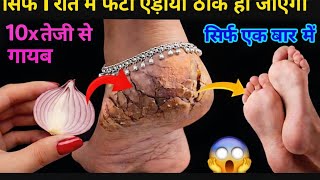 गारंटी है ! 1 ही रात में फटी एड़ियांये ठीक जादुई उपाय सॉफ्ट-मुलायम करेगा 😱 Cracked Heels  screenshot 1