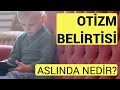 OTİZM NEDİR? OTİZM BELİRTİLERİ #DİKKAT #ŞAŞIRACAKSINIZ OTİZM NEDENLERİ ve OTİZM TEDAVİSi OTİZM NEDİR? OTİZM BELİRTİLERİ #DİKKAT #ŞAŞIRACAKSINIZ OTİZM NEDENLERİ ve OTİZM TEDAVİSi