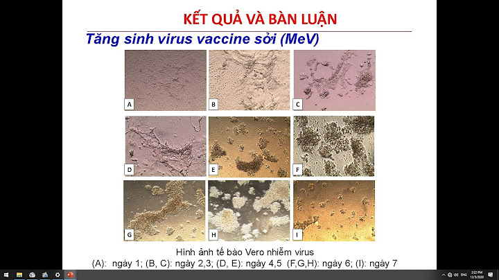 Chỉ số đánh giá diệt virus invitro