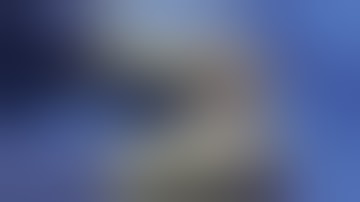 VASCADE MVP Procedure  - Multi Vessel Closure Following Cardiac Cryoablation Dr Suneet Mittal