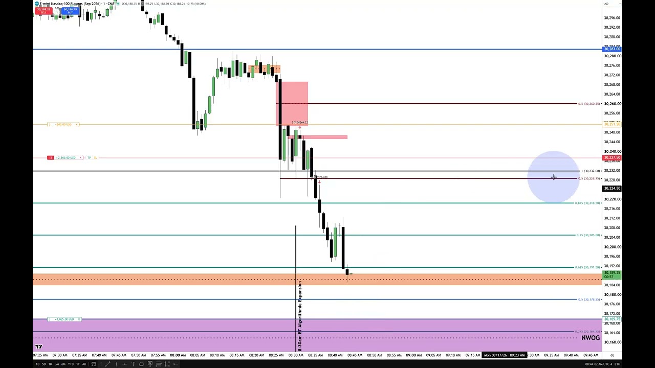 Trade Management & Removing The Need To Be Right: video thumbnail