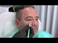 Acido Hialuronico Facial( Region Periorbitaria, Malar y Tercio Medio) por Dr Martin Gaston Alvarez