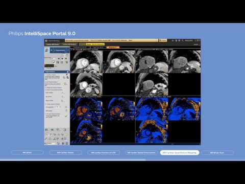 Philips IntelliSpace Portal 9.0 clinical application MR Cardiac