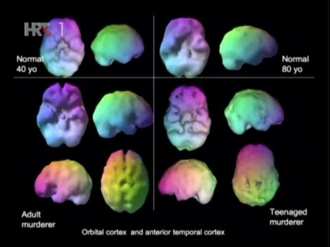 Na Rubu Znanosti - Neuroplastičnost Mozga i Moć Uma
