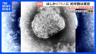 今年のはしか感染者数479人 前年同期比4.1倍に　東京都が約半分の人数占める｜TBS NEWS DIG