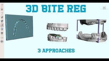 Three Approaches to Maintain a Registered Bite When 3D Printing Dental Models