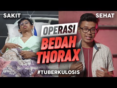 Berawal Dari Sakit BATUK Berakhir DIOPERASI PARU-PARU (TBC)