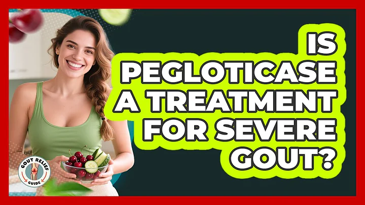 Is Pegloticase A Treatment For Severe Gout? - Gout Relief Guide