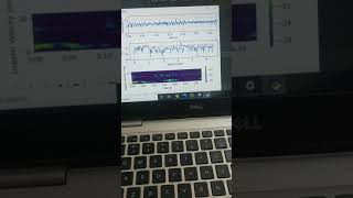 Doppler Radar signal processing