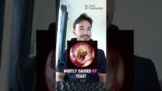 Owners don't have a clue about these 3 things I find every year on dogs