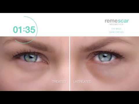 remescar eye bags & dark circles remescar eye bags & dark circles