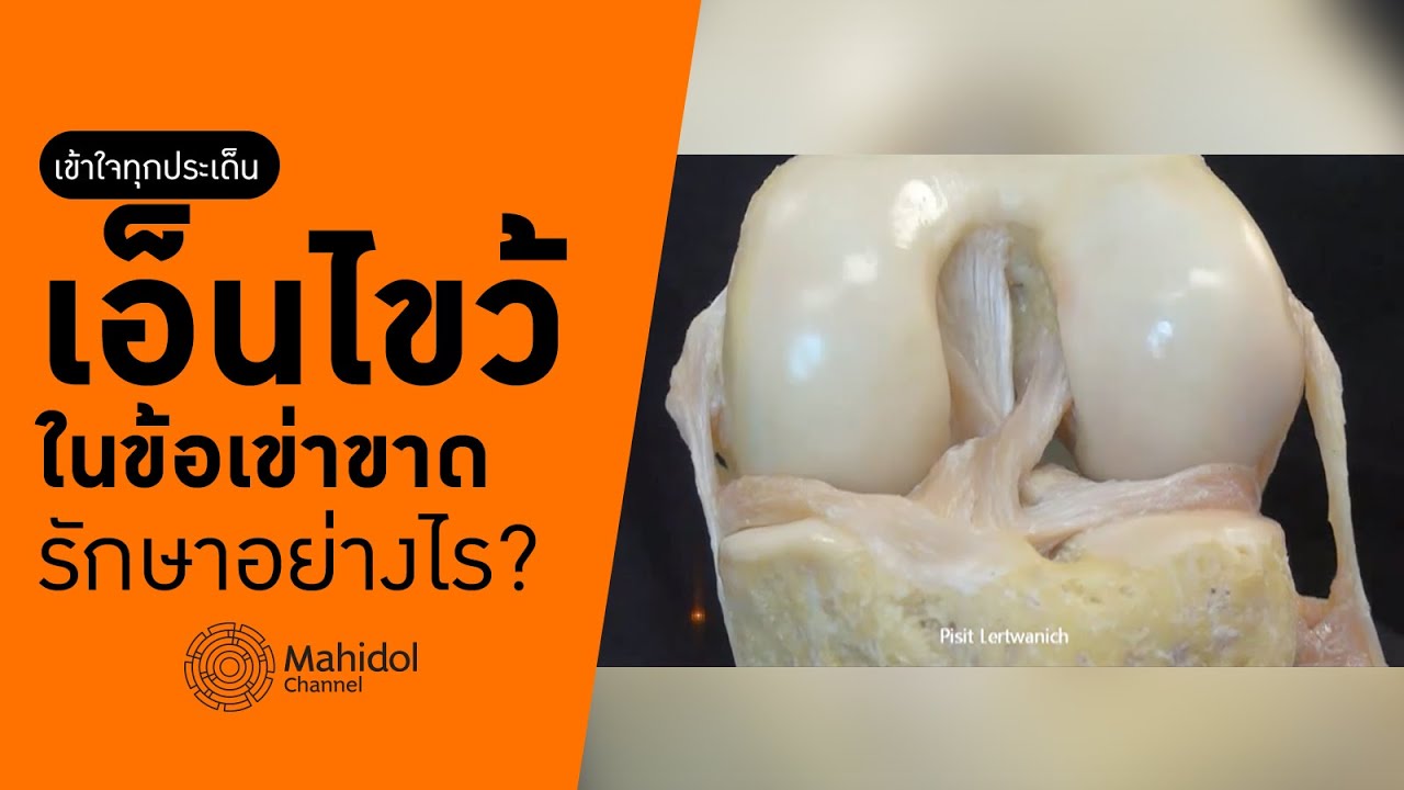 ‘เอ็นไขว้ในข้อเข่าขาด’ รักษาอย่างไร? [หาหมอ by Mahidol Channel]