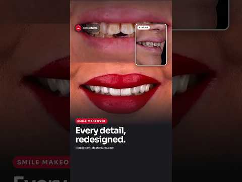 Every detail, redesigned.