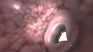 Right Atrium Visualization