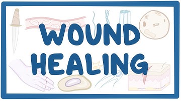 Wound healing