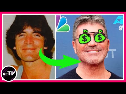 Simon Cowell Plastic Surgery The Untold Truth