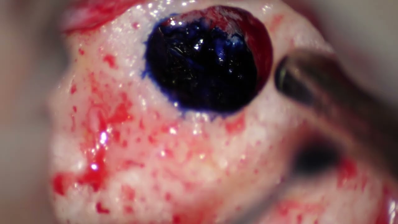 VIDEO 6