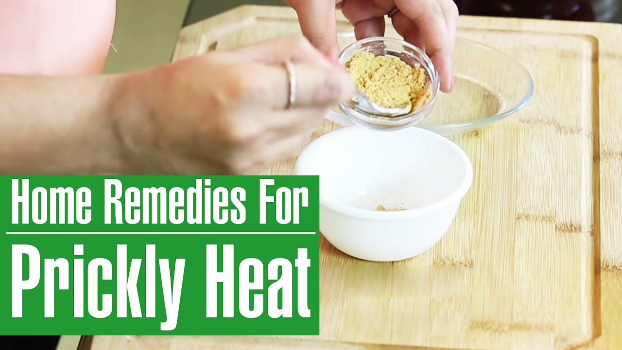 28 Home Remedies For Prickly Heat That Provide Quick Relief