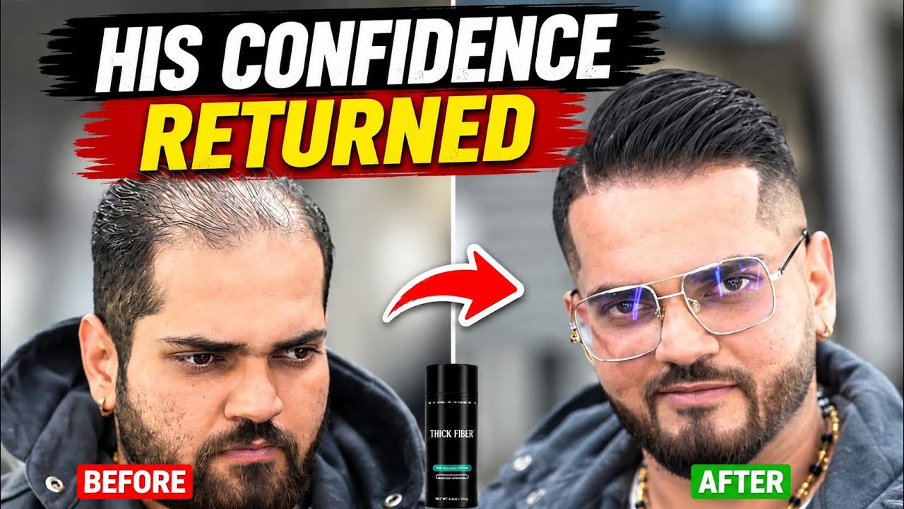 MAKEOVER: Thinning & Balding Haircut - YouTube