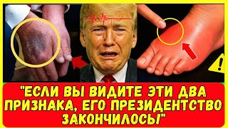 Здоровье Трампа в КРИЗИСЕ? ШОКИРУЮЩИЙ Медицинский АНАЛИЗ Доктора! (Срочное Обращение)