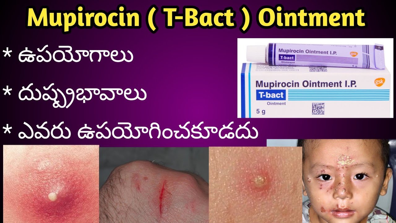 T-Bact ( Mupirocin) ointment Uses and Side effects in Telugu.