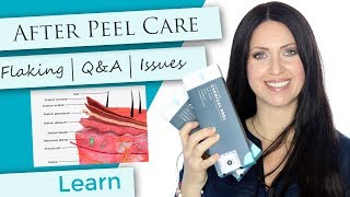 Chemical Peels | Flaking | What to Expect | Q&A |Pink .. Itching .. Dark skin
