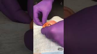 Ear Lobe Piercing