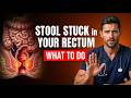 Stool STUCK in the Rectum! What Is It and What To Do?