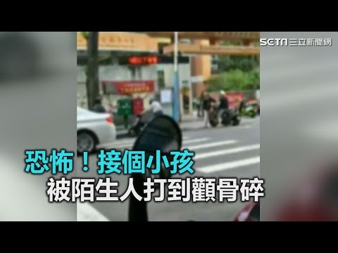 恐怖！接個小孩被陌生人打到顴骨碎｜三立新聞網SETN.com
