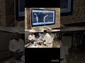 Robotic Knee replacement | Johnson &amp; Johnson Demo #shorts #kneepain