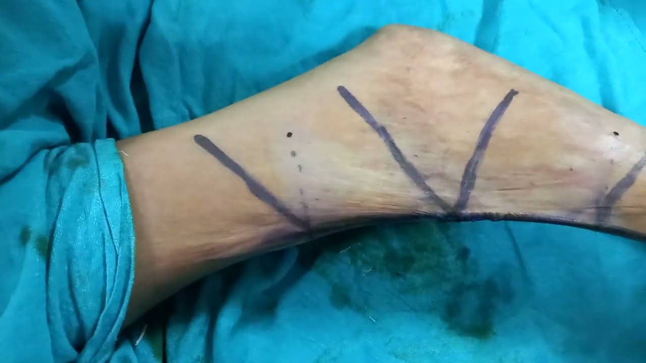 外傷形成外科 Emergency Plastic Surgery 0107-705x1024.jpg