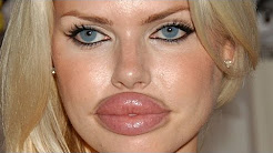 Worst Plastic Surgeries Ever!